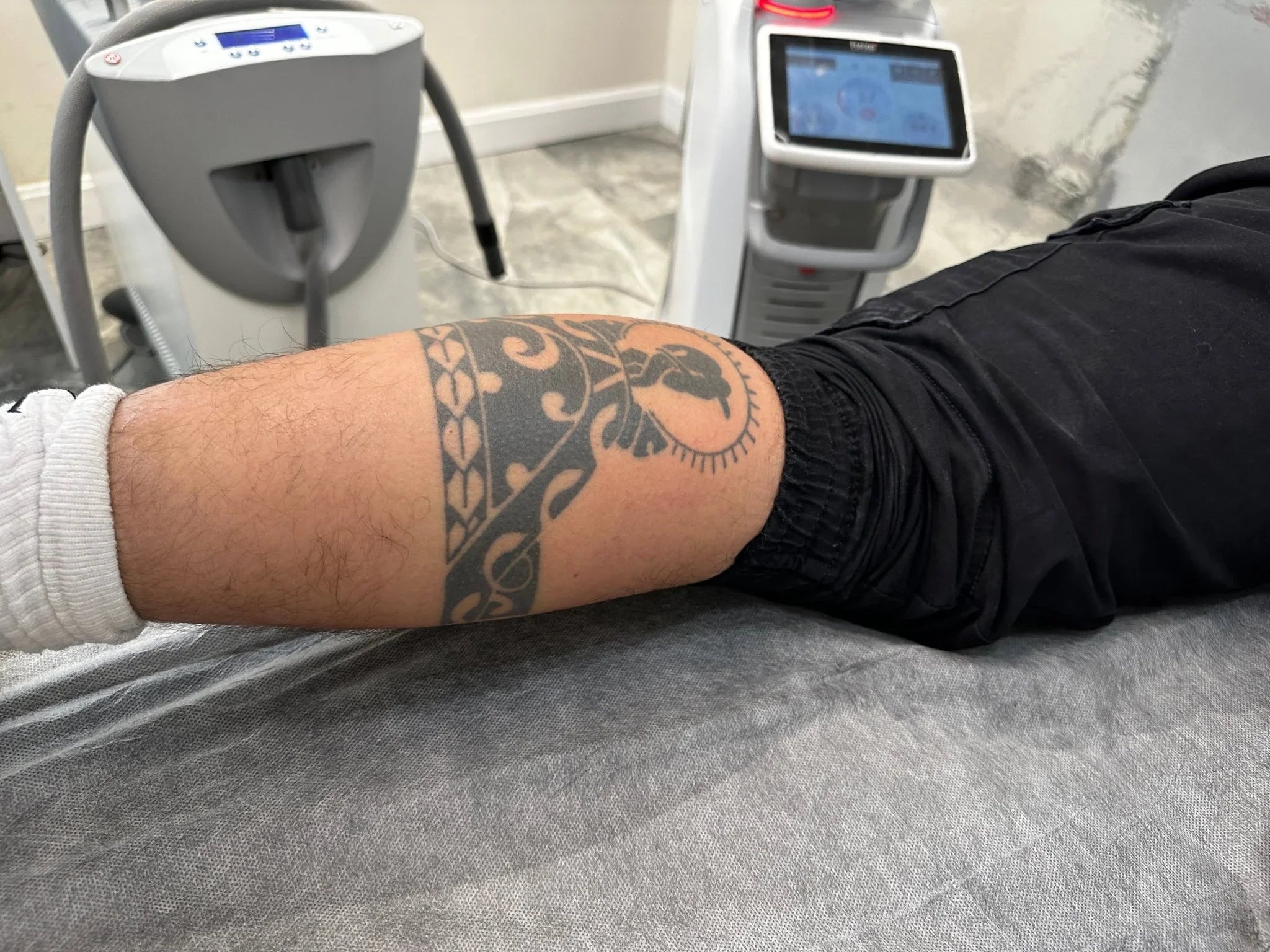 מתחת לעור: ההשפעה הארוכה של קעקועים על הגוף